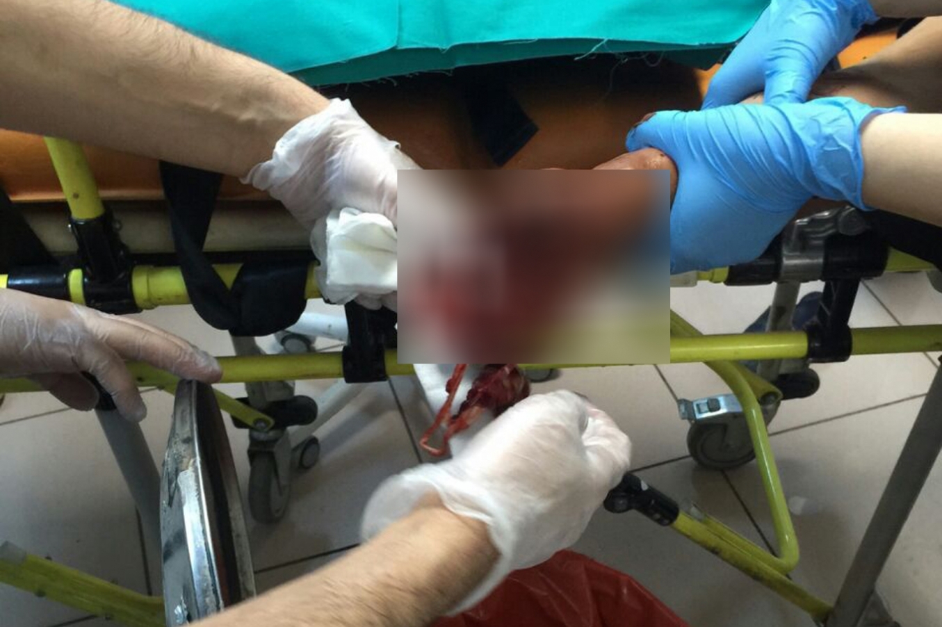Elinde torpil patlayan genç yaralandı Elinde torpil patlayan genç yaralandı